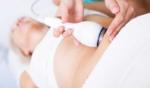 Fat Freezing