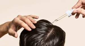 Minoxidil vs Fin