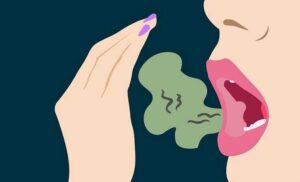 The easiest bad breath remedies that you even try at home