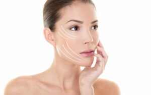 Are You Ready For A Facelift