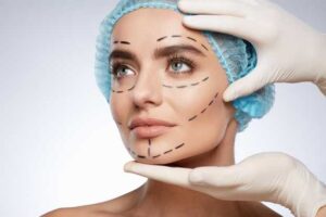 Liposuction