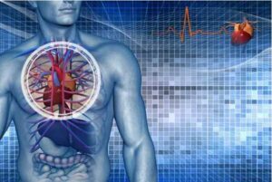 Vascular Disease
