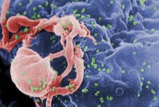 How to Safeguard Yourself from HIV Transmission