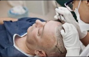 When Should You Get A Hair Treatment?
