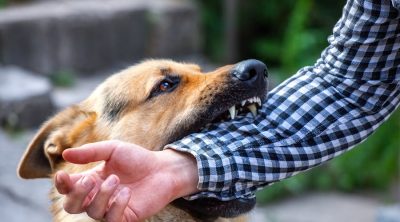 Want to Know Seek Compensation for Animal Bite Injuries in Wisconsin?